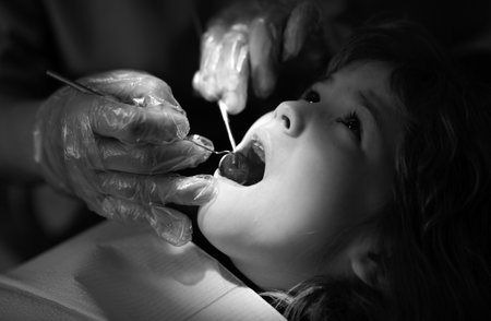 Teeth checkup at dentists, examining teeth close up. Dentist examining kids teeth in the dentists...
