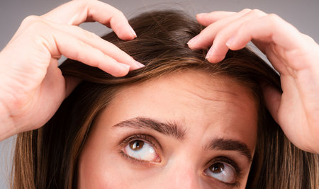 Woman with hair problem. Woman is looking shocked to her lost hair. Head bald and hair treatment concept.の写真素材