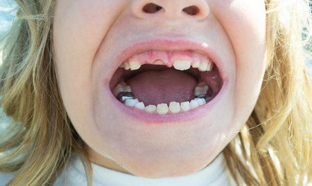 Child with tooth gap. Dental kid closeup mouth. New teeth growing. Toothless kids dental smile....