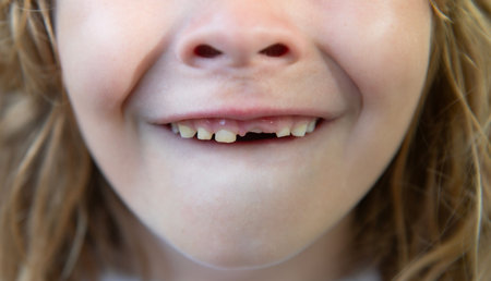 Smiling child with missing teeth. Kid showing tooth gap. Closeup of baby teeth. Child losing milk...