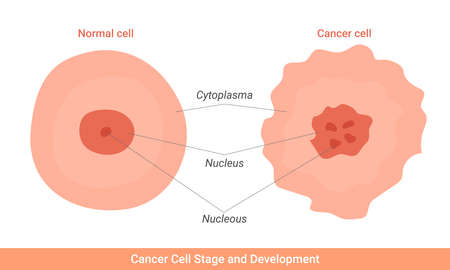 Cancer cell stage and development illustrationのイラスト素材