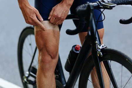 Man pointing on leg after sun burning during cyclingの写真素材