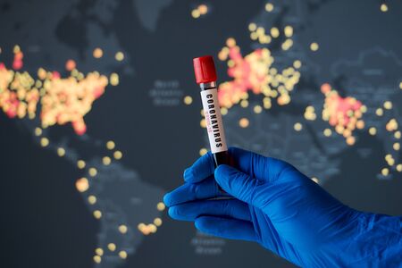 A positive coronavirus blood test with a world map on the background. A world map with confirmed cases of COVID-19. Coronavirus disease 2019 situation update worldwide spread.の写真素材