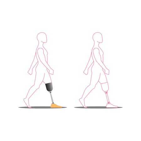 Disabled person with prosthetic leg medical vector illustration, silhouette of a walking invalid.のイラスト素材