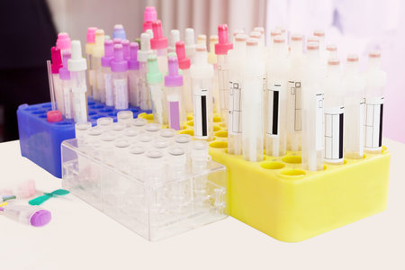 The image of test tubes in the box