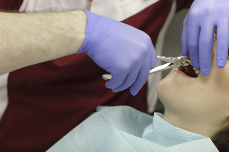 Dentist extracts a tooth from a woman patientの写真素材