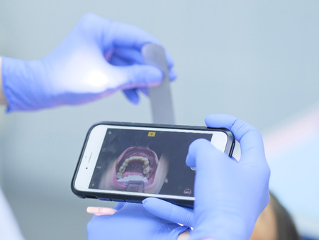 Dentist films the patient's mouth with smartphoneの写真素材