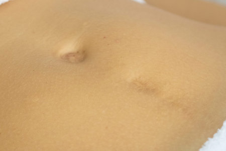Surgical scar on womanâ€™s abdomen