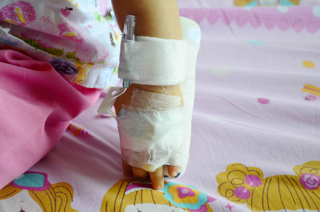 Intrevenous (IV) saline tube infusion for medical therapy on asian baby hand, one year old babyの写真素材