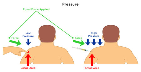 Pressure Infographic Diagram example of touching shoulder by index finger and injection equal force result in low pressure for large area high pressure for small area physics science education vectorのイラスト素材