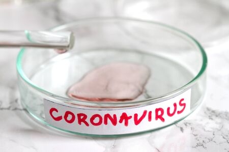 Coronavirus in laboratory and reserch conceptの写真素材
