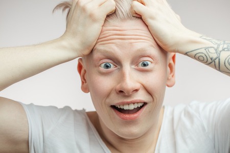 Emotional overjoyed surprised Albino male model with bugged eyes and open mouth.の写真素材