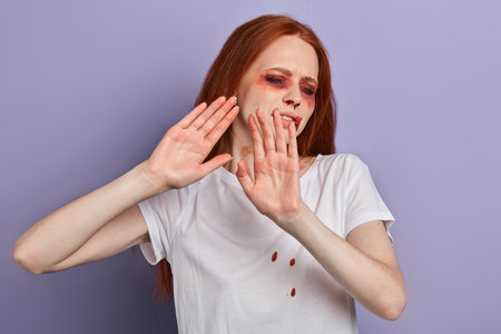 Stop hurting women Young beaten up scared ginger woman with closed eyes stretching out hand while...