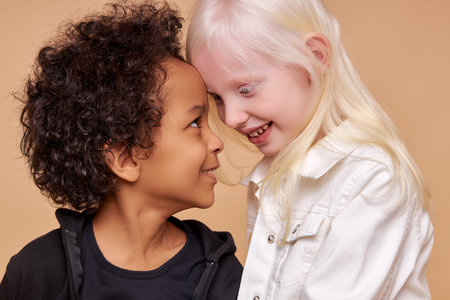 close friendship between two children of different nationalities, beautiful caucasian albino girl...