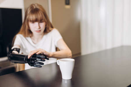 contact with a cup. first touch after surgern. close up photo. disabled girl attempts to reach the cup, copy space, attemptの写真素材