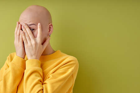 Hairless female is closing eyes, frightened and scared about something, isolated on green studio background, copy space. Portrait of emotional lady in casual yellow shirt, allopecia or cancer conceptの写真素材