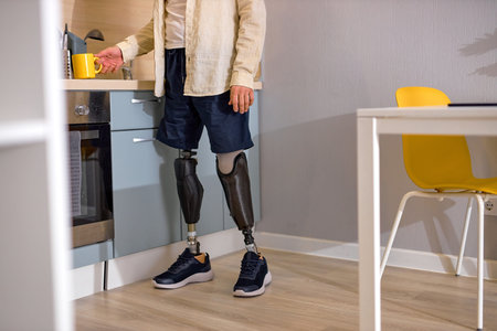cropped handicapped or disabled person with disability standing on bionic smart prosthesis in...