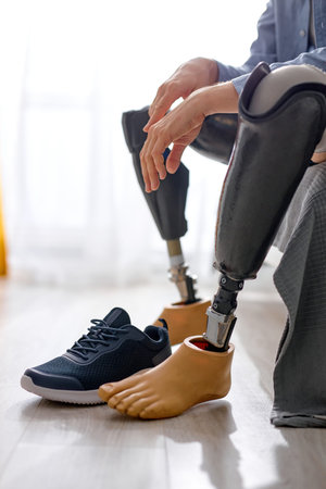 cropped man leg amputee wearing or changing prostheses at home sitting on bed in bright room, alone....