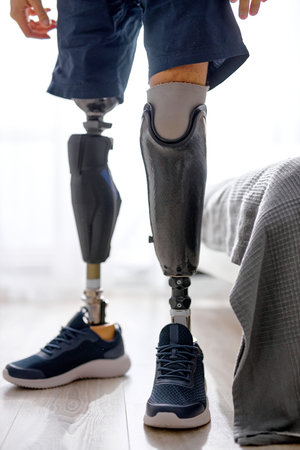 unrecognizable cropped man with prosthesis in sneakers standing on floor at home, try to start new life, getting used to artificial leg. never give up. disability conceptの写真素材