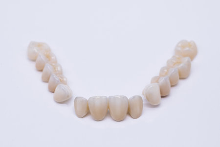 Ceramic zirconium in final version. Staining and glazing. Precision design and high quality materials. Metal Free Ceramic Dental Crowns.の写真素材