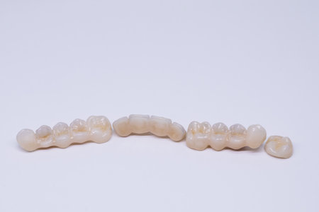 Beautiful ceramic teeth. Porcelain crown and bridge. Dental ceramic bridge in wite background. Metal free ceramic dental crowns.の写真素材