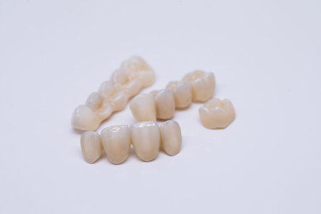Metal Free Ceramic Dental Crowns. Dental bridge isolated on wite made of ceramic porcelain....