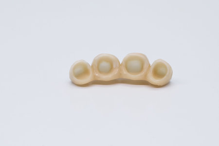 Metal free ceramic dental crowns. Dental ceramic bridge on isolated wite background