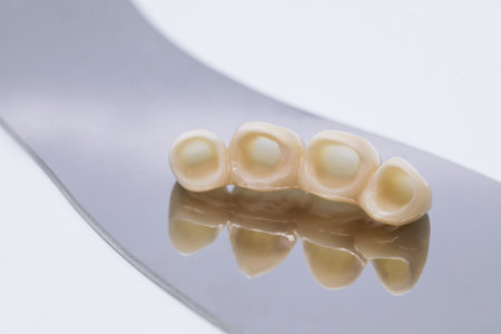 Dental ceramic veneers and crowns. Metal free ceramic dental crowns.の写真素材