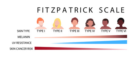Fitzpatrick scale. Skin types infographic with male and female faceless characters. Human phototypes. Melanin, UV resistance, skin cancer risk diagrams. Vector illustrationのイラスト素材