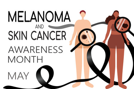 Melanoma and skin cancer awareness month background. Poster template with male and female characters checked moles, birthmarks under magnifying glass. Vector illustrationのイラスト素材