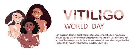 World vitiligo day background template. Women with vitiligo. Diverse female characters with depigmentation skin. Self love, body positive. Copy space. Vector illustrationのイラスト素材