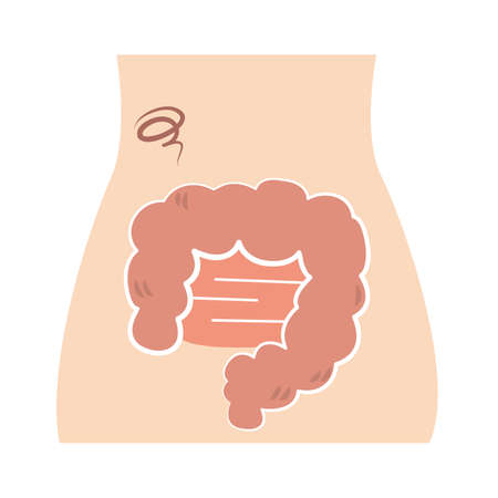Unhealthy and reasonably dirty intestines.のイラスト素材