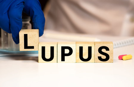 Wooden block form the word LUPUS. Medical concept.