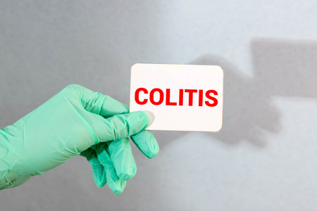 Ulcerative Colitis disease term, a long term condition where the colon and rectum become inflamed, medical conceptual image.の写真素材