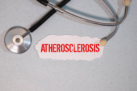 Atherosclerosis text with Red heart, Magnifying glass and Medical Stethoscope on wooden backgroundの写真素材
