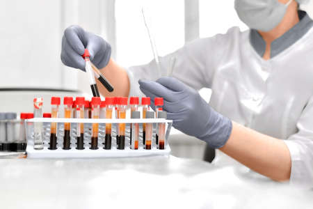 The work of the laboratory assistant with blood tests in test tubes. Hand gestures in protective gloves.の写真素材