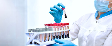 The work of the laboratory assistant with blood tests in test tubes. Hand gestures in protective...