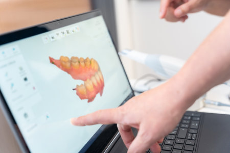 A doctor in the dental clinic explaining and looking at the 3d of the x-ray on the computerの写真素材