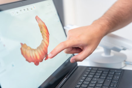 A doctor in the dental clinic explaining and looking at the 3d of the x-ray on the computerの写真素材