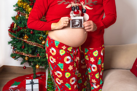 Young couple with red Christmas decorations and clothes having an ultrasound of the new child for...