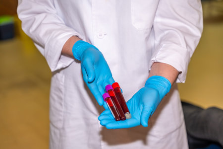 unrecognizable doctor with blue gloves collecting samples of blood and holding them in a donation...