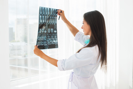 doctor looking at x-ray or MRI concept healthcare, medical and radiology conceptの写真素材
