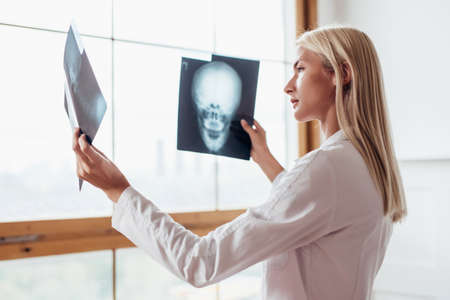 Female radiologist looks at scans of skull.の写真素材