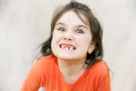 defocused funny close up face portrait of Little agressive naughty girl with angry smile and missed front milk teeth on white backgroundの写真素材