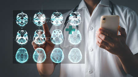 A doctor does a pointed analysis, diagnoses a patient's brain testing findings with a stethoscope, and gives futuristic healthcare. The concept is to deliver health care over the internet.の写真素材