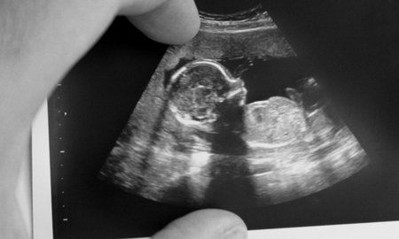 Ultrasound of a baby in the hands of his dad - happiness