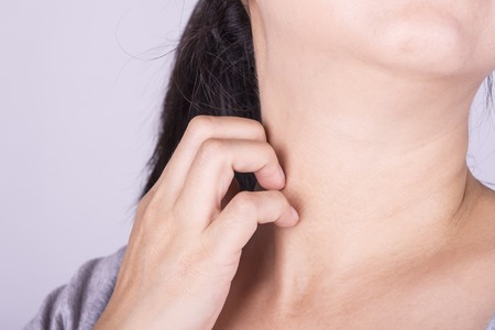 Women scratch the itch with hand. Concept photo with Healthcare And Medicine.の写真素材