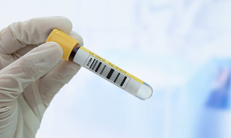 Doctor holding sample blood collection tube for test in the laboratory. medical test concept.の写真素材