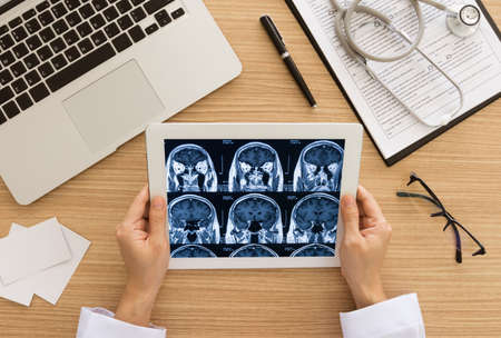 Medical Healthcare Brain Concept. Doctor check up scan brain image from digital tablet screen. above view.の写真素材