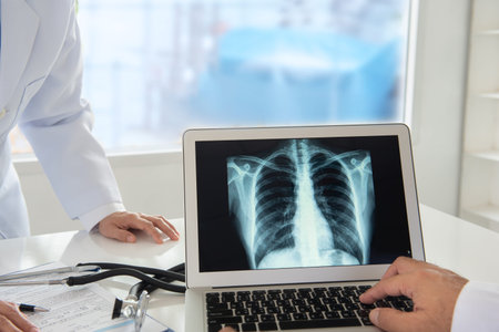 Doctor examining at lungs radiograph x-ray film of patient in operation room.